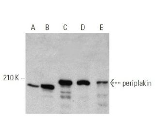 western blotting image from recommended periplakin (G-1) monoclonal antibody replacement. Image 359521