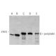 western blotting image from recommended periplakin (G-1) monoclonal antibody replacement. Image 359521