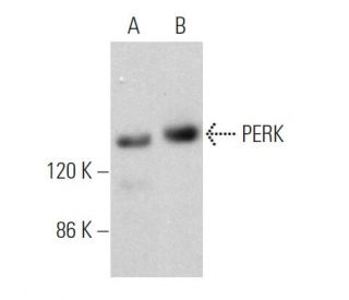 PERK Antibody (B-5) - Western Blotting - Image 360385