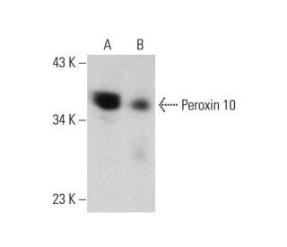Peroxin 10 Antibody (Y-2D3) - Western Blotting - Image 384299 