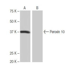 Peroxin 10 Antibody (Y-2D3) - Western Blotting - Image 65033 