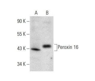 Peroxin 16 Antibody (H-4) - Western Blotting - Image 301458The Double Nickase Plasmid features a U6 promoter for sgRNA expression, a 20 nt targeting sequence, and a gRNA scaffold to guide Cas9n. It includes a CBh promoter for Cas9n (D10A) and puromycin resistance, GFP for transfection verification, and nuclear localization signals (NLS). The 2A peptide allows co-expression of Cas9n and Puro from a single promoter, enabling precise genome editing with reduced off-target effects.