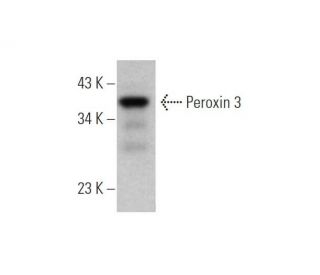 Peroxin 3 Antibody (B-6) - Western Blotting - Image 344270The Double Nickase Plasmid features a U6 promoter for sgRNA expression, a 20 nt targeting sequence, and a gRNA scaffold to guide Cas9n. It includes a CBh promoter for Cas9n (D10A) and puromycin resistance, GFP for transfection verification, and nuclear localization signals (NLS). The 2A peptide allows co-expression of Cas9n and Puro from a single promoter, enabling precise genome editing with reduced off-target effects.