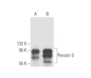 Peroxin 5 Antibody (F-9) - Western Blotting - Image 58165 