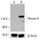 Peroxin 6 Antibody (F-6) - Western Blotting - Image 414108