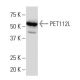 PET112L Antibody (47.1) - Western Blotting - Image 34336