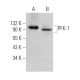 PFK-1 Antibody (G-11) - Western Blotting - Image 361112