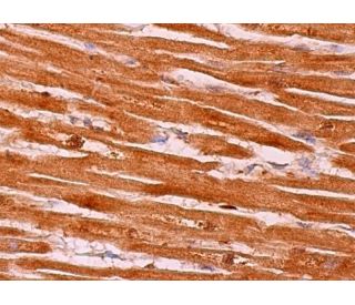 immunohistochemistry image from recommended PFK-1 (E-4) monoclonal antibody replacement. Image 379102