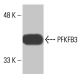 PFKFB3 Antibody (3F3) - Western Blotting - Image 348566