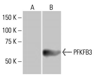 PFKFB3 Antibody (3F3) - Western Blotting - Image 352129 
