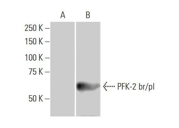 PFK-2 br/pl Antibody (3F3) | Santa Cruz Animal Health