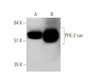 PFK-2 car Antibody (D-1)