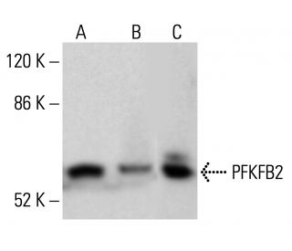 PFK-2/PFKFB2 Antibody (D-1) - Western Blotting - Image 354961 