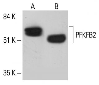 PFK-2/PFKFB2 Antibody (G-7) - Western Blotting - Image 349078 