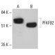 PFK-2/PFKFB2 Antibody (G-7) - Western Blotting - Image 349078 