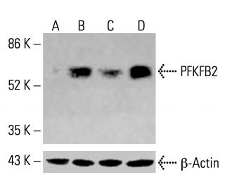 PFK-2/PFKFB2 Antibody (D-1) - Western Blotting - Image 414964