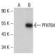PFKFB4 Antibody (A-1) - Western Blotting - Image 332787
