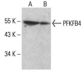 PFKFB4 Antibody (A-1) - Western Blotting - Image 351856 