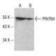 PFKFB4 Antibody (A-1) - Western Blotting - Image 351856 