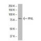 PFKL Antibody (YT4) - Western Blotting - Image 33914