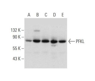 PFKL Antibody (A-6) - Western Blotting - Image 297860Each CRISPR/Cas9 Knockout (KO) Plasmid product consists of a pool of 3 plasmids designed to ensure identification and cleavage of a specific gene for maximum knockout efficiency. Each plasmid encodes a unique 20 nt sequence derived from the GeCKO (v2) library.