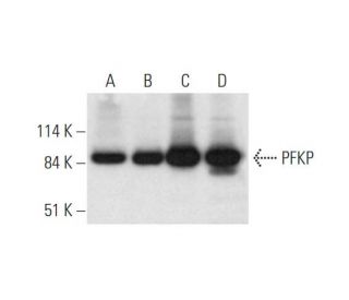 PFKP Antibody (F-7) - Western Blotting - Image 332822 