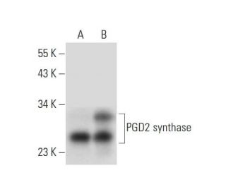 PGD2 synthase Antibody (G-5) - Western Blotting - Image 299010