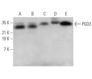 PGD2 synthase Antibody (H-10) - Western Blotting - Image 371053 