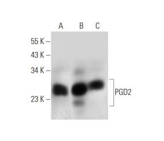 PGD2 synthase Antibody (T-17): sc-14825