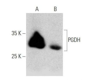western blotting image from recommended PGDH (H-3) monoclonal antibody replacement. Image 358674