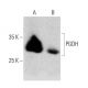Cet anticorps polyclonal n'est plus commercialisé. Voir l'anticorps monoclonal <a href="pgdh-antibody-h-3">PGDH (H-3)</a> que nous recommandons (données d'échantillonnage indiquées). western blotting image from recommended PGDH (H-3) monoclonal antibody replacement. Image 358674