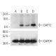 PGE2: sc-201225. Western blot analysis of DAP12 expression in untreated (A), PMA treated (B), Cholecalciferol treated (C)