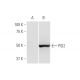 PGI2 synthase Antibody (3B11) - Western Blotting - Image 347569 