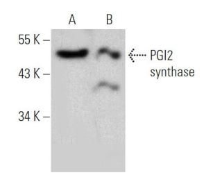 western blotting image from recommended PGI2 synthase (3B11) monoclonal antibody replacement. Image 368186