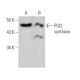 western blotting image from recommended PGI2 synthase (3B11) monoclonal antibody replacement. Image 368186