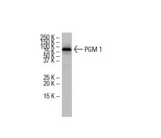 PGM 1 Antibody (Y-173) - Western Blotting - Image 33784 