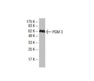 PGM 3 Antibody (EC-13) - Western Blotting - Image 33783 