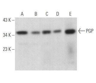 Anti Pgp Antibody E 10 Scbt Santa Cruz Biotechnology