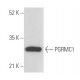 PGRMC1 Antibody (12B7) - Western Blotting - Image 356751