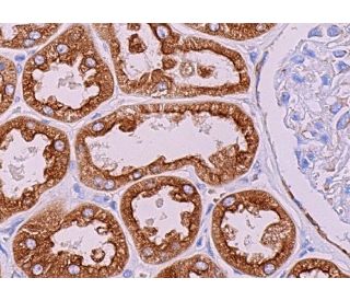 immunohistochemistry image from recommended PGRMC1 (C-4) monoclonal antibody replacement. Image 374748