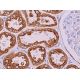 This polyclonal antibody has been discontinued. See our recommended <a href="pgrmc1-antibody-c-4">PGRMC1 (C-4)</a> monoclonal antibody (sample data shown). immunohistochemistry image from recommended PGRMC1 (C-4) monoclonal antibody replacement. Image 374748