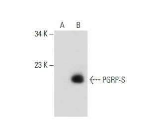 PGRP-S Antibody (G-1) - Western Blotting - Image 139090Each CRISPR/Cas9 Knockout (KO) Plasmid product consists of a pool of 3 plasmids designed to ensure identification and cleavage of a specific gene for maximum knockout efficiency. Each plasmid encodes a unique 20 nt sequence derived from the GeCKO (v2) library.