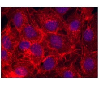 水晶アステロイドfromブラジル 楽天市場】○Sサイズ【水晶アステロイド(小星型12面体)】幅約18mm-21mm