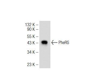 PheRS Antibody (F-9) - Western Blotting - Image 74505 