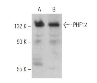 PHF12 Antibody (G-3) - Western Blotting - Image 369415 