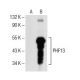 PHF13 Antibody (E-4) - Western Blotting - Image 153978