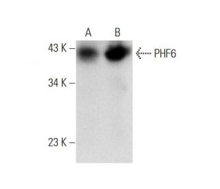 PHF6 Antibody (G-9): sc-271767