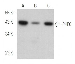 PHF6 Antibody (G-9) - Western Blotting - Image 366116Each CRISPR/Cas9 Knockout (KO) Plasmid product consists of a pool of 3 plasmids designed to ensure identification and cleavage of a specific gene for maximum knockout efficiency. Each plasmid encodes a unique 20 nt sequence derived from the GeCKO (v2) library.