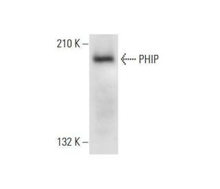 PHIP Antibody (B-1) - Western Blotting - Image 306574Each CRISPR/Cas9 Knockout (KO) Plasmid product consists of a pool of 3 plasmids designed to ensure identification and cleavage of a specific gene for maximum knockout efficiency. Each plasmid encodes a unique 20 nt sequence derived from the GeCKO (v2) library. 