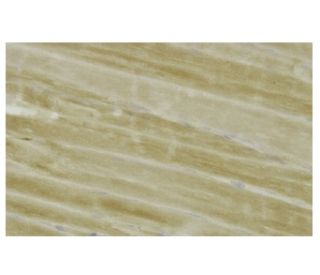 PHKG1 Antibody (RR-34) - Immunohistochemistry - Image 36061